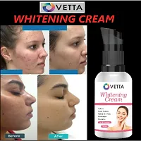 Ovetta  Whitening Cream Pack Of 01-thumb2