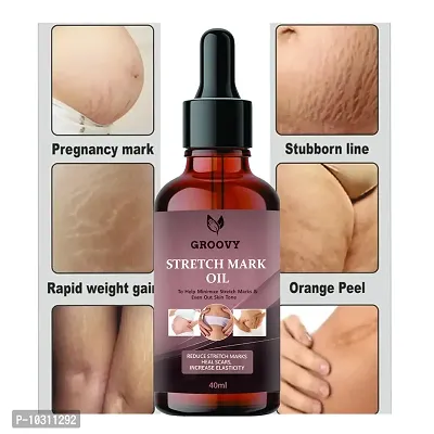 Stretch Marks Oilpregnancy And Maternity Stretch Marks Removal Cream Stretch Marks Oils 40Ml-thumb0