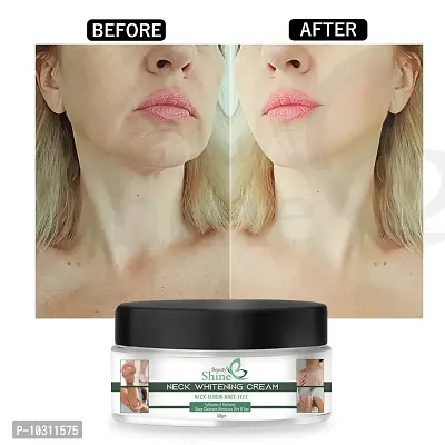 Dark Under Arm Cream For Whitening Dark Spot Removal Body Creams Armpit Whitening Cream Formula - 50 Gm-thumb0