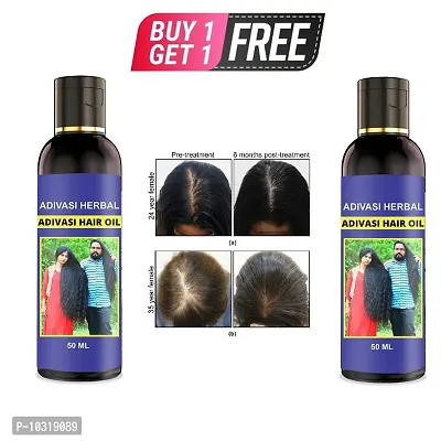 Neelambari Premium Quality Of Hair Medicine For Hair Growth Anti Dandruff Prevent Hair Fall 50 Ml Hair Oil 50 Ml Buy 1 Get 1 Free-thumb0