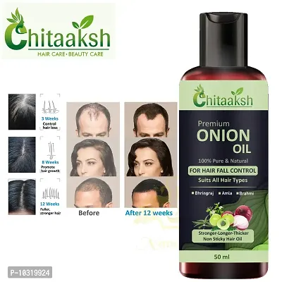 Red Onion Oil Help For Rapid Hair Growth,Anti Hair Fall,Split Hair And Promotes Softer And Shinier Hair 50Ml, For Man And Women-thumb0