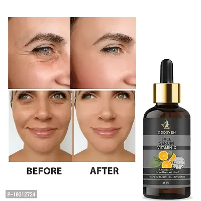 Vitamin C Serum For Face Pigmentation And Oily Skin