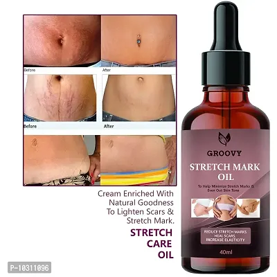 Stretch Mark Oil With The Goodness Of Seabuckthorn Oil, Vitamin E And C, Lavender All Skin Types For Scars And Stretch Marks-40Ml-thumb0