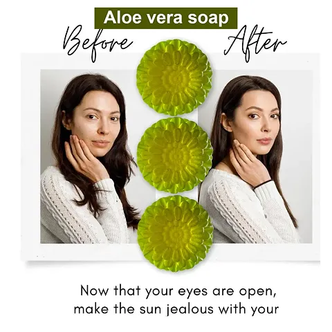 Herbal Aloe Vera Cleansing Soap-100 Grams Each, Pack Of 3