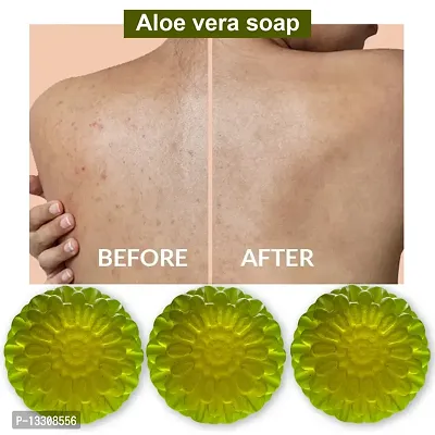 Aloe Vera Soap With Eucalyptus Essential Oil-100 Grams Each, Pack Of 3-thumb0