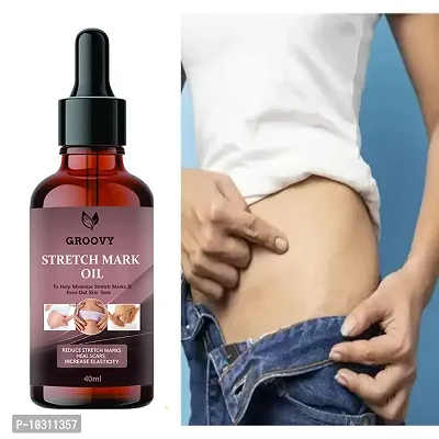 Stretch Marks Oil Soothing Scar And Stretch Mark Removal Oil Pregnancy And Postpartum Safe All-Natural, Paraben-Free 40 Ml-thumb0