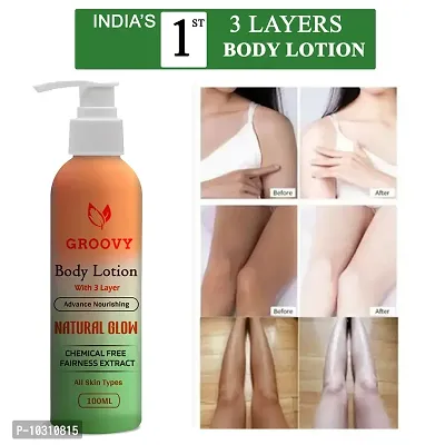 Whitening Lotion With For Normal, Dry And Itchy Skin- 100 Ml-thumb0