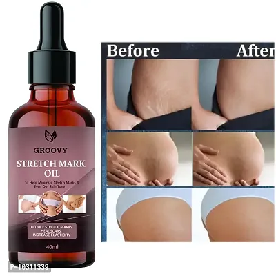 Stretch Marks Oil Ayurvedic Body Massage Bio Oil For Stretch Marks, Oil For Scar Removal, Aging And Wrinkled Skin 40 Ml-thumb0