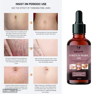 Stretch Marks Oil Anti Stretch Mark Removal Oil Women And Men, Marks And Spots Removal 40 Ml-thumb0
