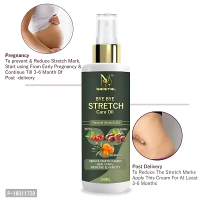 Nainital Stretch Mark And Scar Mark Removal Oil For Men And Women - 100 Ml-thumb0