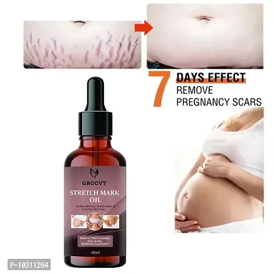 Stretch Marks Oil Skincare Oil For Pregnancy Stretch Marks With Argan Oil Saffron And Vitamin E Combo 40 Ml-thumb0