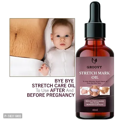 Body Stretch Mark Removal Oil- 40 Ml-thumb0