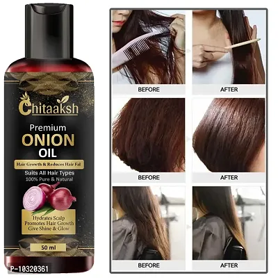 Hair Oil Onion For Hair Growth And Hair Fall Control Herbal Oil50Ml-thumb0