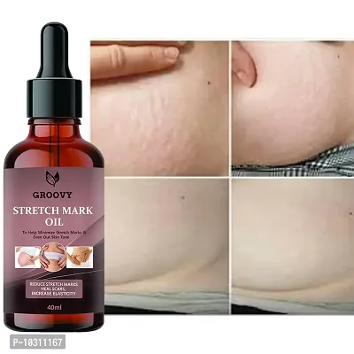 Stretch Marks Oil Organic Body Stretch Mark Removal Oil Anti Aging Pregnancy Stretch Mark Removal Oil Scar Removal Anti Wrinkle Skin Hydration 40 Ml-thumb0