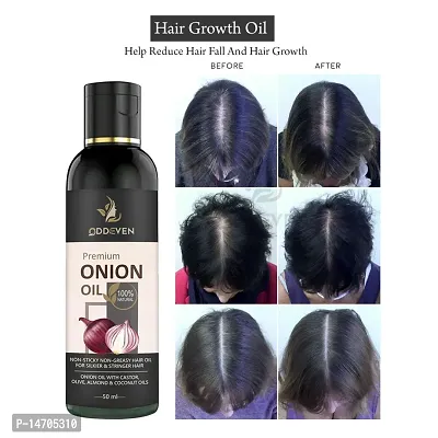 ADIVASI ONION HAIR OIL FOR LONG HAIR, HAIR GROWTH (WOMEN AND MEN) ONION HAIR OIL (50ML) (PACK OF 1)-thumb0