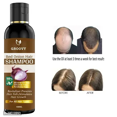 Onion Hair Shampoo - Black Seed Onion Hair Shampoo - Controls Hair Fall - For All Hair Problem Solution - No Mineral Oil, Colour, Sls, Peg For Men And Women- 100 Ml Hair Shampoo Ml-thumb0