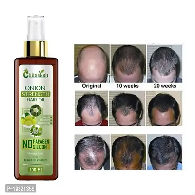 Onion Hair Oil Hair Regrowth Oil Controls Hair Fall And Dandruff For Men And Women - All Natural Blend Of Coconut, Almond, Curry Leaves Oil And More 100 ml-thumb0