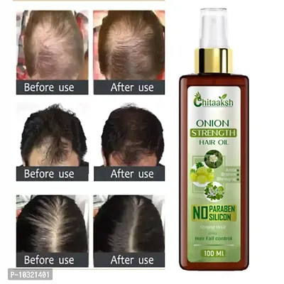 Onion And Bhringraj Hair Oil With 4X Growth Action - Stimulates The Roots And Prevents Baldness 100 Ml Hair Oil- 100 Ml-thumb0