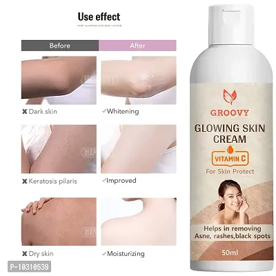 &nbsp;Intense Moisture Skin Whitening Body Lotion With Peach Milk Extracts And Vitamin E- 50 ml-thumb0