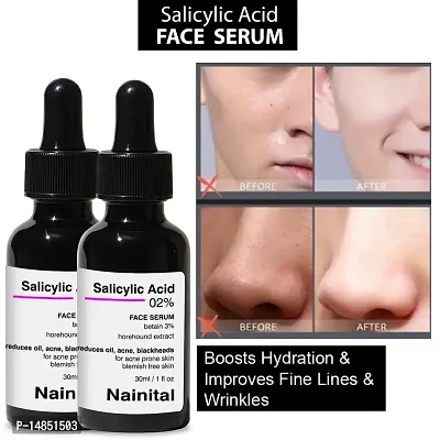 Our Salicylic Acid Serum: The Key to Clearer Skin-thumb0