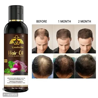 Onion Black Seed Hair Oil 50Ml For Man And Women-thumb0