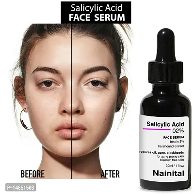 Our Salicylic Acid Serum: The Key to Clearer Skin-thumb4