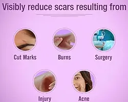 Scars Skin Care For Scars-thumb1