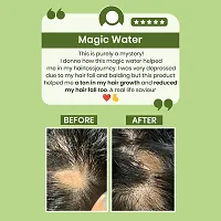 Frygen Rosemary Water For Hair Growth-thumb3