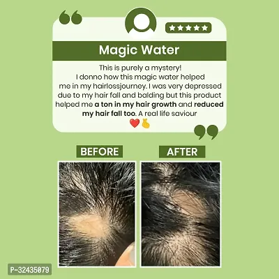 Frygen Rosemary Water For Hair Growth-thumb4