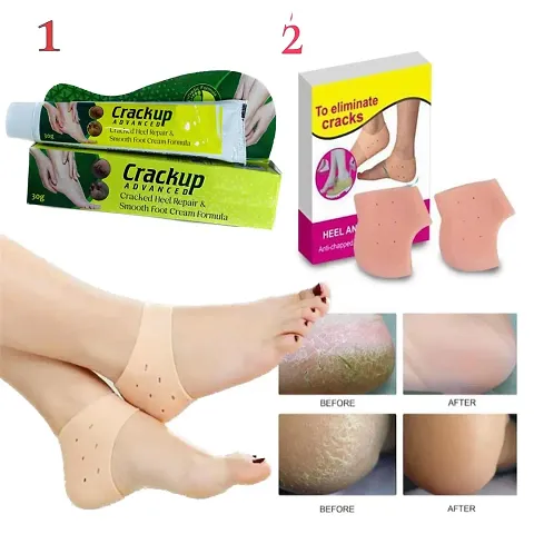 Crack Heel Cream with Best Silicon Pad