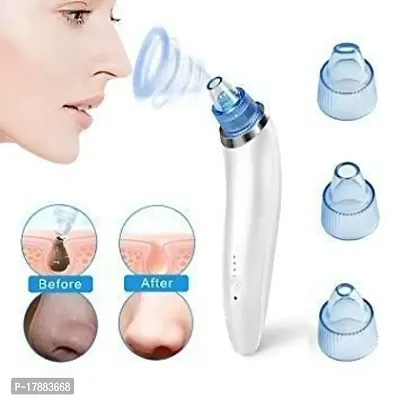 Frankskin Derma Suction Blackhead Remover Vacuum Pimple Sucker Tool For Men And Women Blackheads Remover Tool Kit, Acne Remover, Pore Cleaner, Facial Beauty Care-thumb3