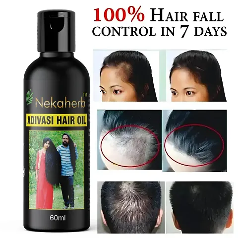 Hot Selling Hair Growth Oils