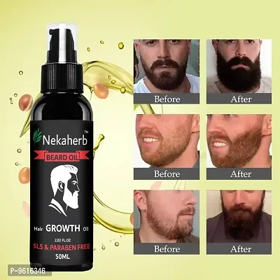 Beard and Hair Growth Oil - 50 ml for faster beard growth and thicker looking beard | Natural Actives Only | No Harmful Chemicals | Beard Oil for Patchy and Uneven Beard | Clinically Tested | Non Stic