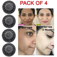 Activated Skin Care Natural Detox Face  Body Charcoal Soap For Blackheads  Anti Wrinkle, Anti Pollution Pack of 4 (4 x 100g)-thumb2