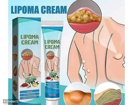 Lipoma cream-thumb0