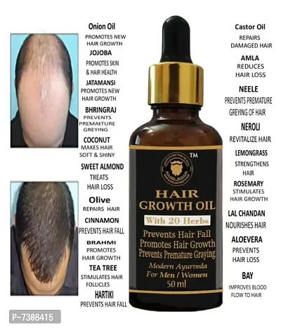 Natural Hair Growth Serum No Side effect  For Male  Female 01-thumb0