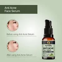 Ayurdaily Anti Acne Face Serum-thumb2