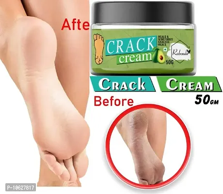 Foot Care Cream Enriched With Cocos Nucifera Oil, Avocado Oil, Almond Oil,50 g