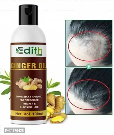 Edith Naturals Ginger Oil Dandruff C-thumb0
