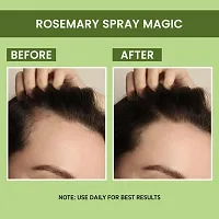 Goodness Rosemary Water | Hair Spray For Regrowth | Hair Growth Expert-thumb1