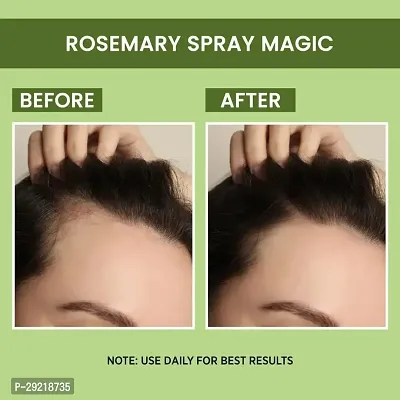 Goodness Rosemary Water | Hair Spray For Regrowth | Hair Growth Expert-thumb2