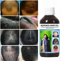 Bussi Adivasi Herbal Hair Oil- 250 ml-thumb4