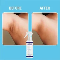 Mabilia 5 Percent Glycolic Acid Underarm Treatment-thumb3