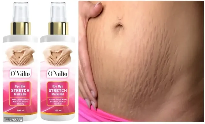 Ovalio Anti Wrinkle Repair Stretch Marks Removal,Pregnancy Stretch Mark Oil (Pack Of 2)(100 ml)