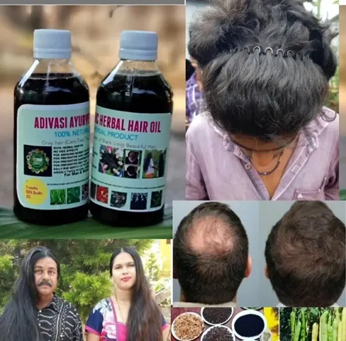 Best Quality Adivasi Herbal Hair Oil