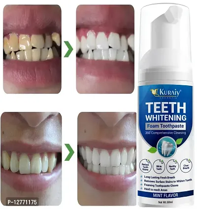 KURAIY New Stain Removal Teeth Whitening Oral Hygiene Teeth Mousse Toothpaste Whitening Foam Teethaid Mouthwash Mouth Wash