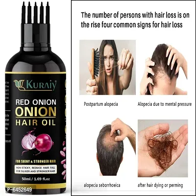 Onion Black Seed Hair Oil for Hair Regrowth and Hair Fall Control Hair Oil 50ml.-thumb0