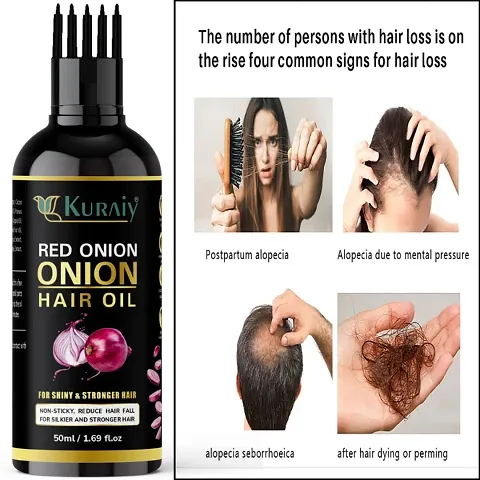 Natural Onion Herbal Oil For Hair Growth