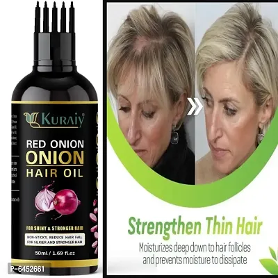 Black Seed Onion Hair Oil - WITH COMB APPLICATOR - Controls Hair Fall - NO Mineral Oil, Silicones, Cooking Oil and Synthetic Fragrance