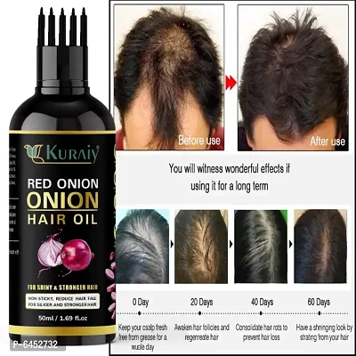 Onion Hair Oil 7 Day Challenge for Hair growth-thumb0